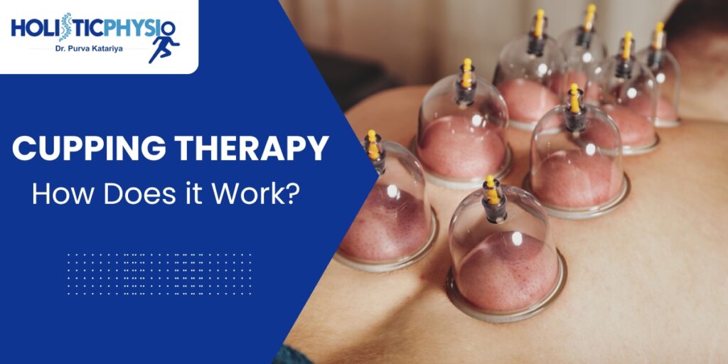 What is Cupping Therapy and How Does it Work?