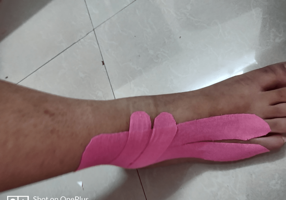 Kinesio Taping